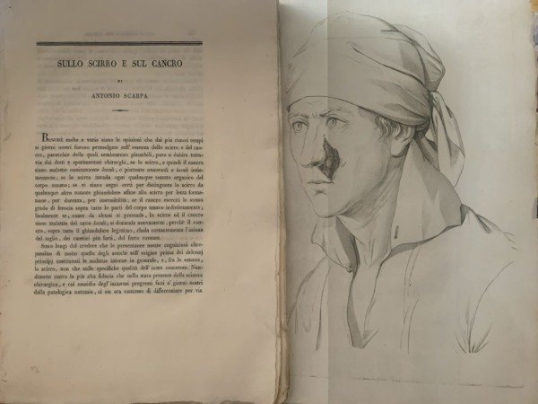 SULLO SCIRRO E SUL CANCRO ANTONIO SCARPA | Immagine principale