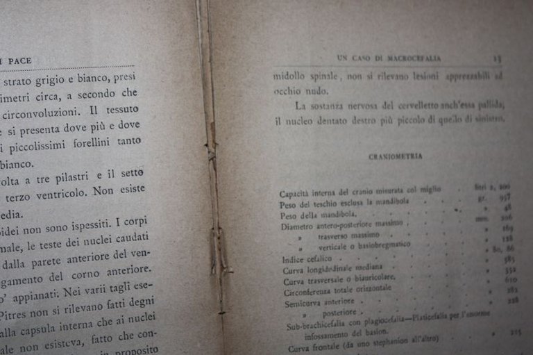 UN CASO DI MACROCEFALIA IL PISANI GAZZETTA SICULA ORGANO DEL …
