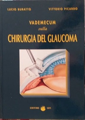 Vademecum sulla chirurgia del glaucoma