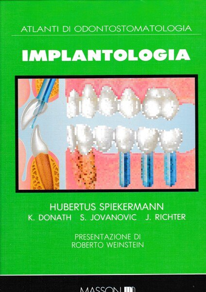 Atlanti di Odontostomatologia. Implantologia