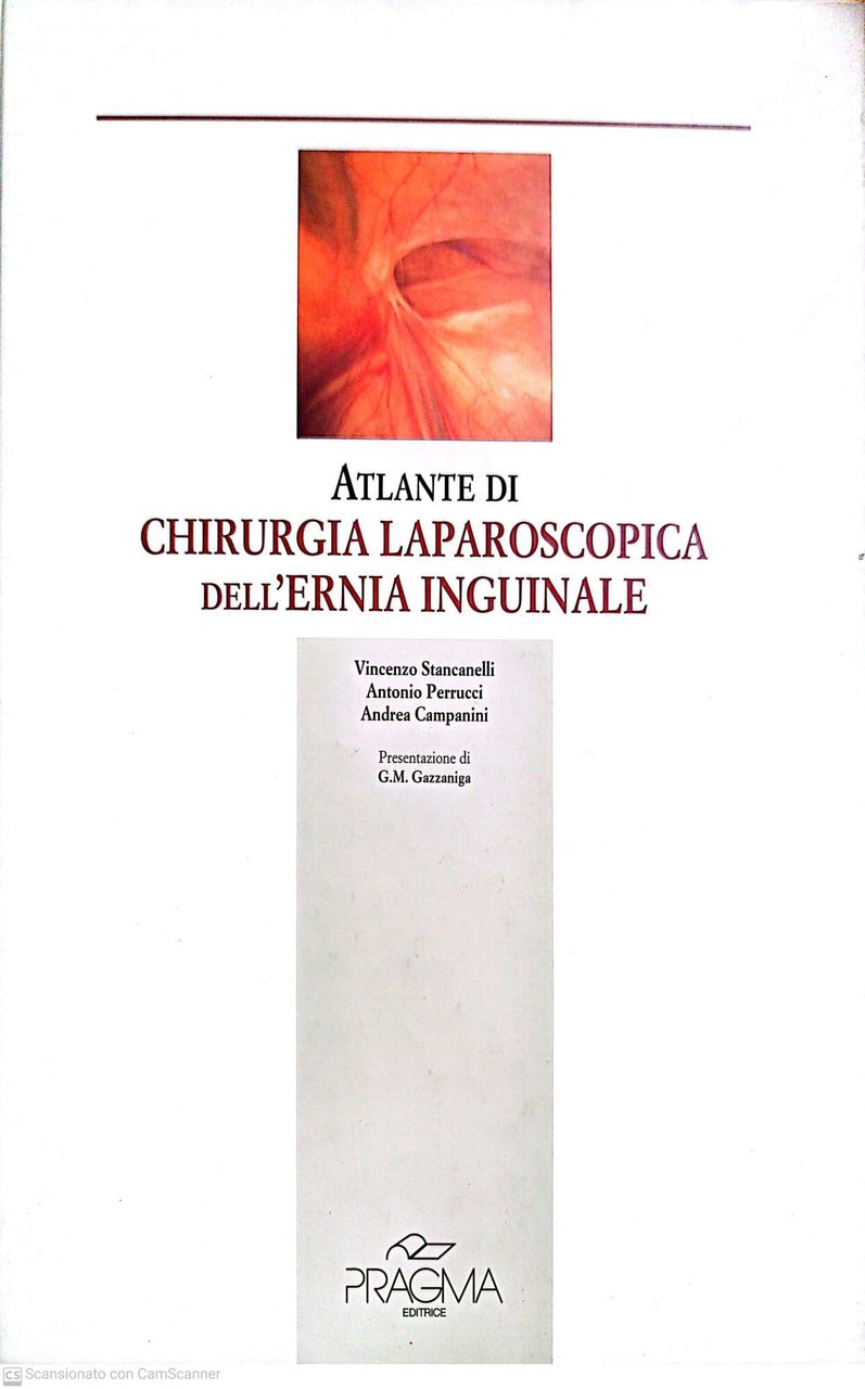Atlante di chirurgia laparoscopica dell'ernia inguinale | Immagine principale