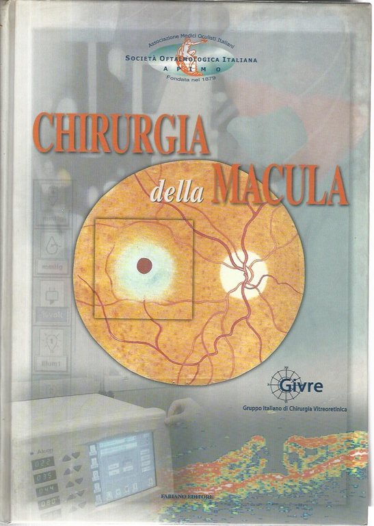 Chirurgia della macula