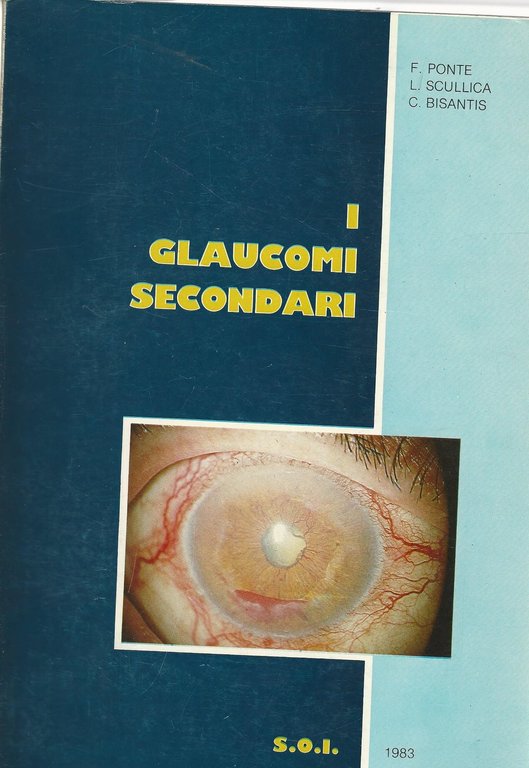 I glaucomi secondari