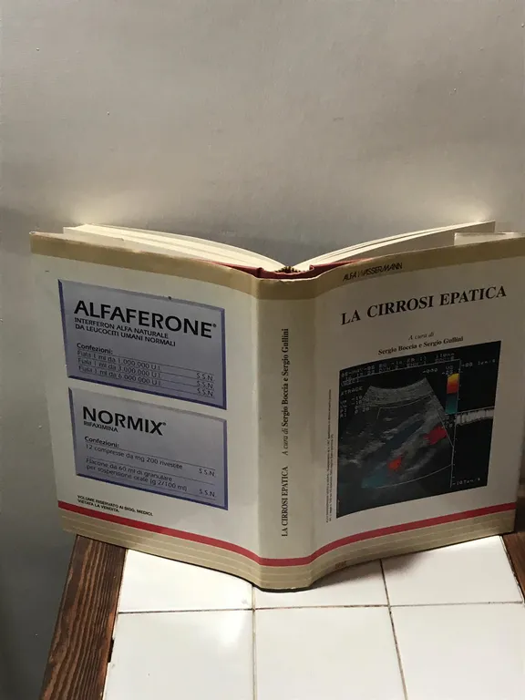 La cirrosi epatica | Immagine Gallery 2