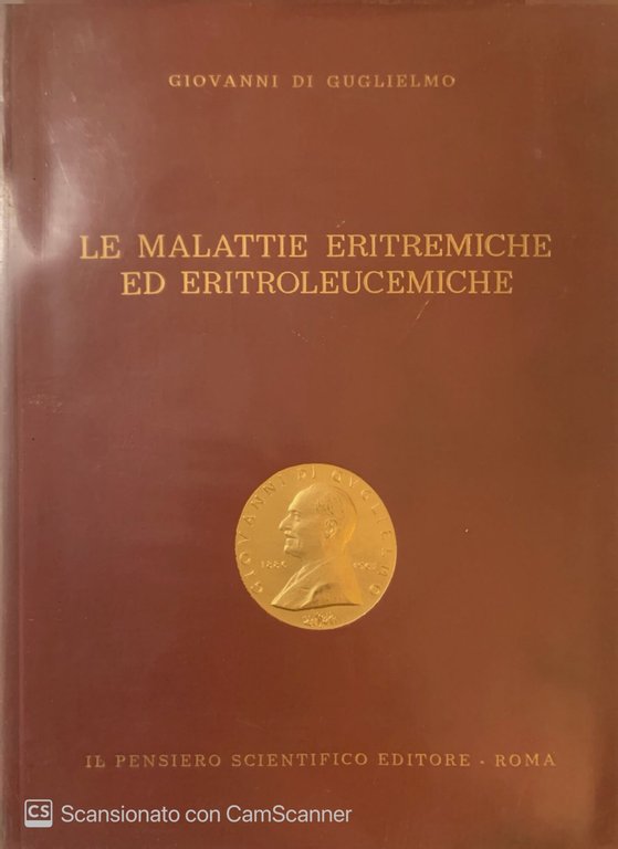Le malattie eritremiche ed eritroleucemiche