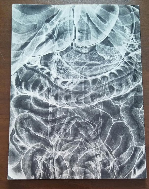 SINTOMI GUIDA ADDOMINALI