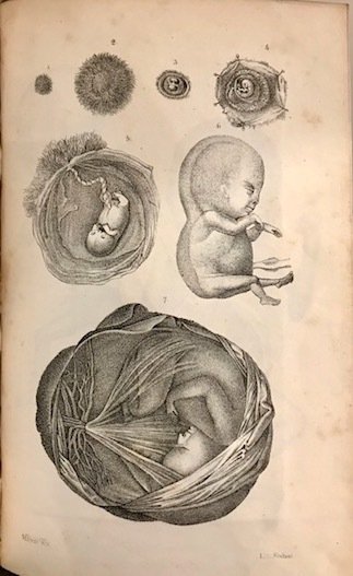 Corso teorico-pratico di ostetricia di F. Capuron. Traduzione italiana di … | Immagine Gallery 1