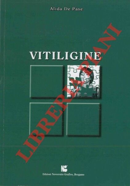 Vitiligine.