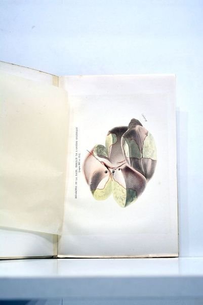 Fragments d'études pathologiques et cliniques.