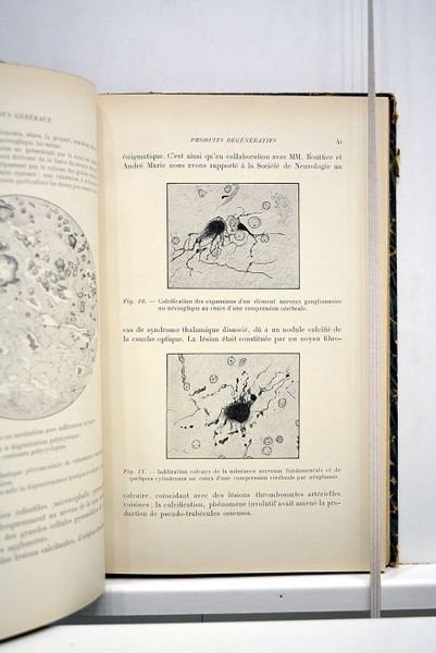 Les processus de désintegration nerveuse. Préface du professeur Pierre Marie.