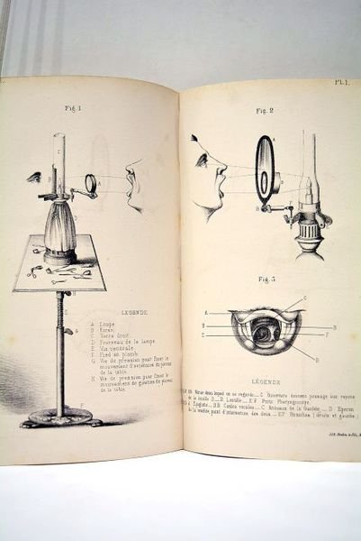 [ Le Laryngoscope à Cauterets. Etude sur le Gargarisme Laryngien. …