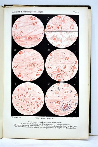 Die bakteriologie in der augenheilkunde. Mit 87 zum teil farbigen …