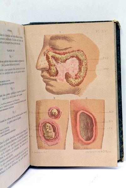 Traité pratique des maladies des voies urinaires et des organes …