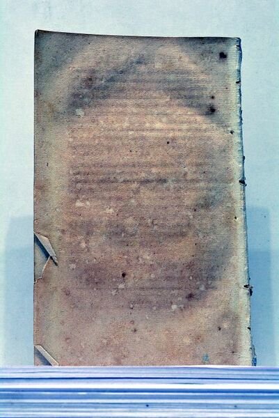 Essai sur les Tumeurs Scrophuleuses, présenté à l'Ecole de Médecine …