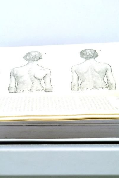 Traitement des Déviations de la Taille sans Appareils. Faits Pratiques.