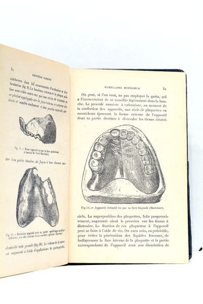 Prothèse restauratrice bucco-faciale et traitement des fractures des maxillaires.