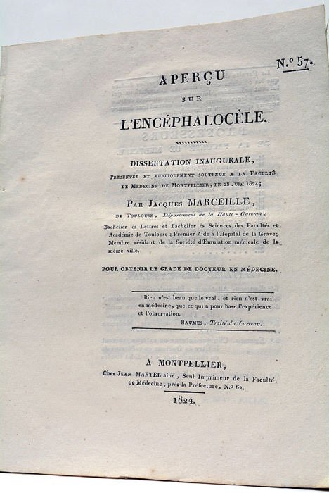 Aperçu sur l'Encéphalocèle. | Immagine principale