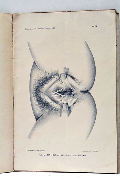 Bartholinische Drüsen mit doppelten Ausführungsgängen.