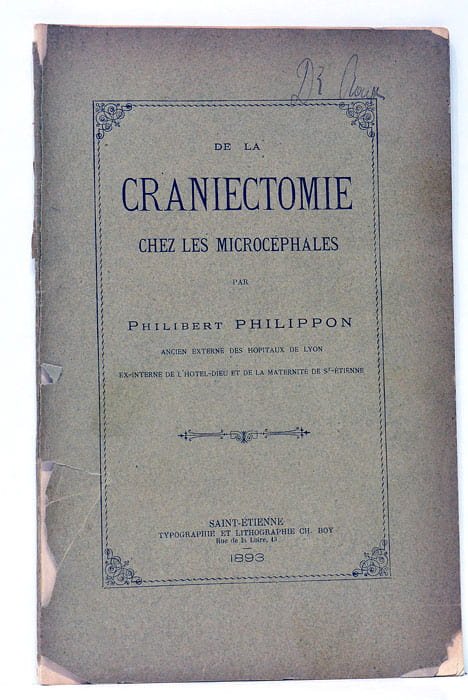 De la Craniectomie chez les Microcéphales.
