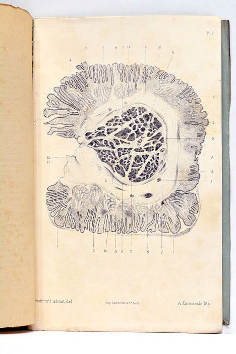 De quelques variétés de tumeurs congénitales de l'ombilic et plus …