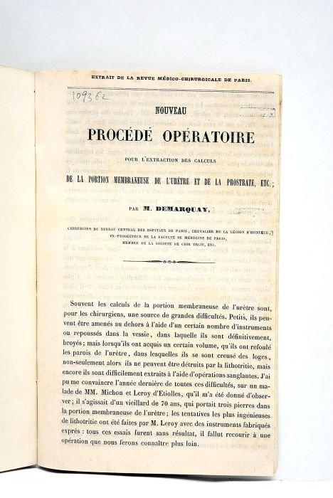 Des blessures de l'artère mammaire interne sous le point de …