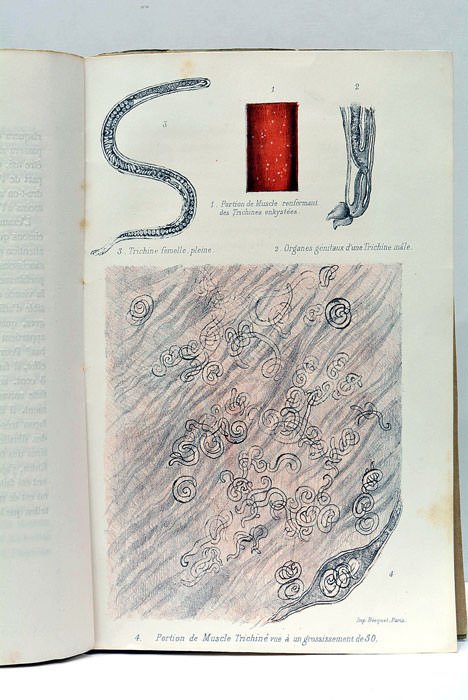 Des trichines à l'usage des médecins et des gens du …