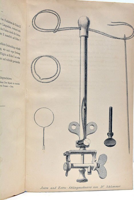 Die Porro-Operation oder die Neue Kaiserchnitt-Méthode nach Porro.