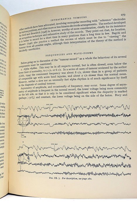 Electroencephalography. A Symposium on Its Various Aspects.