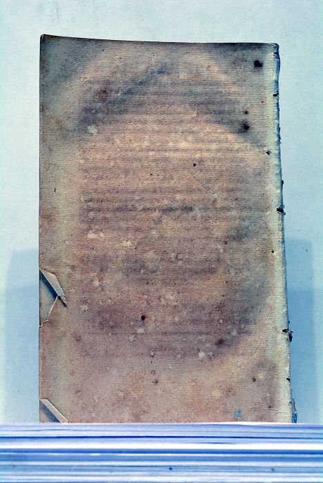 Essai sur les Tumeurs Scrophuleuses, présenté à l'Ecole de Médecine …