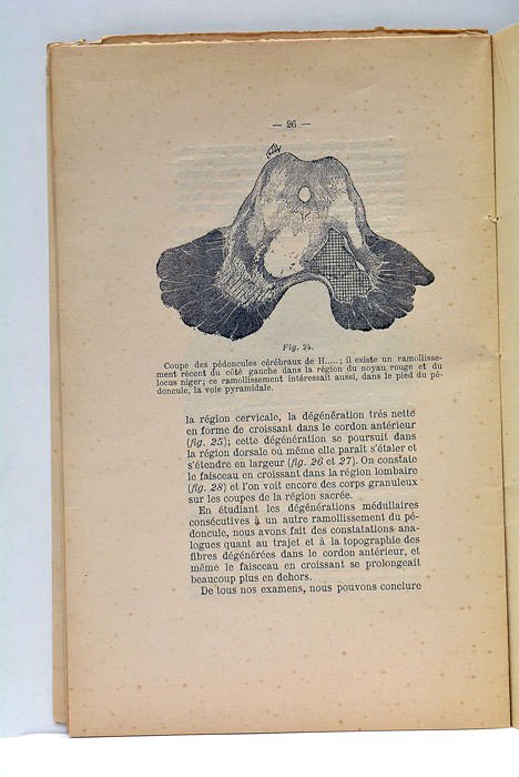 FAISCEAU PYRAMIDAL DIRECT (Le) et le Faisceau en Croissant.