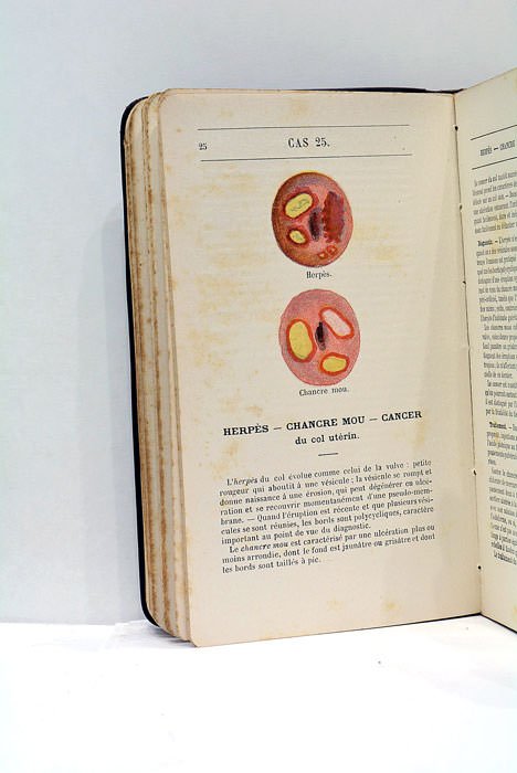 Formulaire gynécologique illustré.