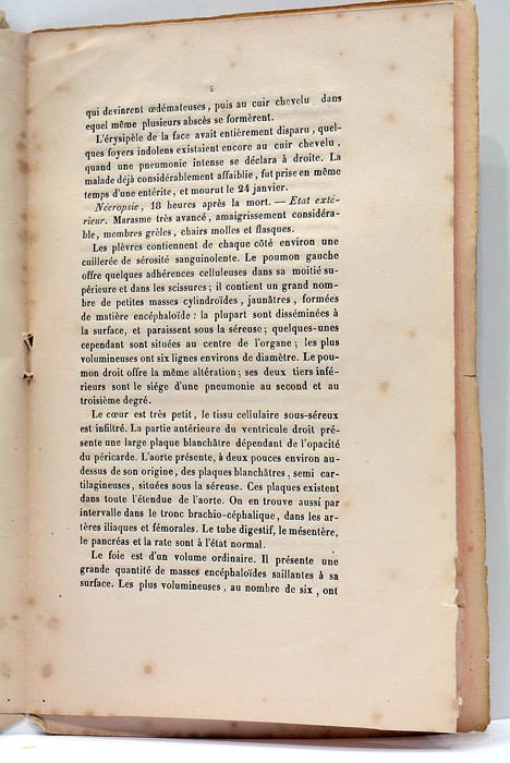 Hémiplégie Faciale produite par une Lésion de la cinquième et …