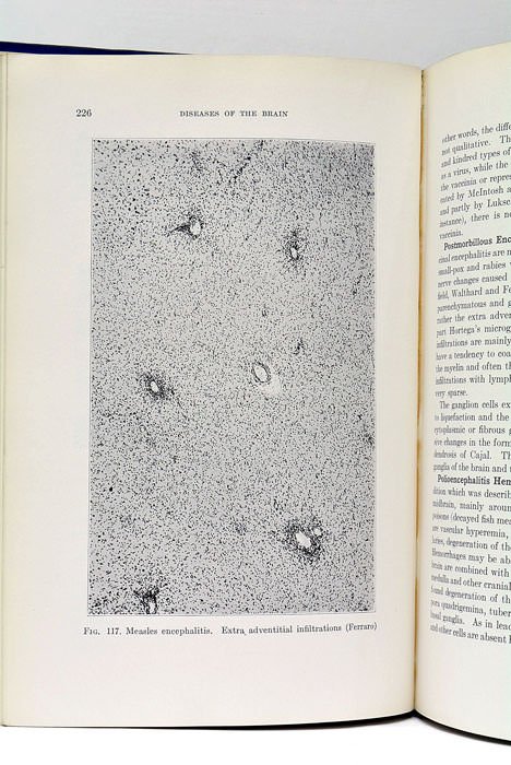 Histopathology of the Peripheral and Central Nervous Systems.