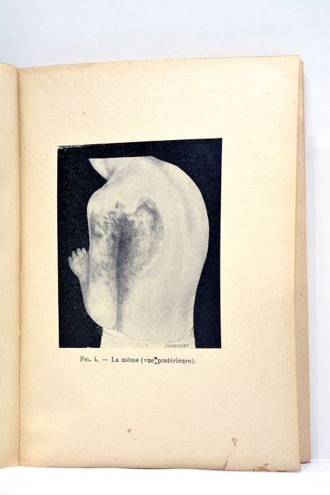 La pratique de l'héliothérapie. 4me édition.