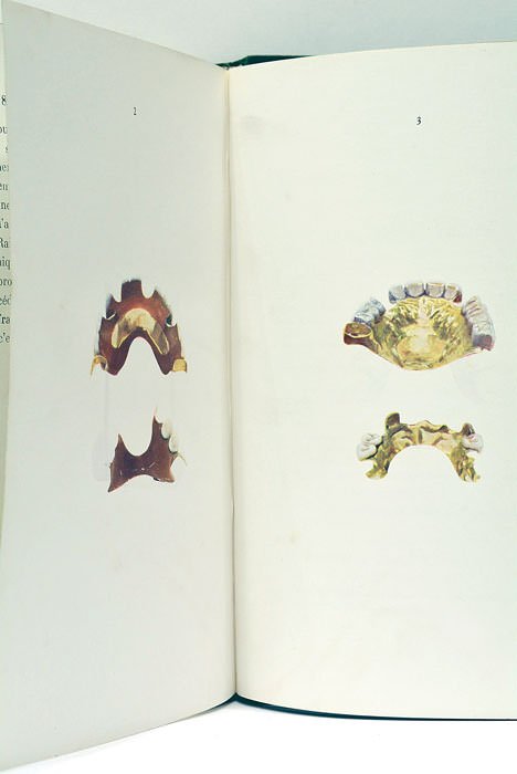 La prothèse dentaire indispensable. Avec 130 figures dans le texte …