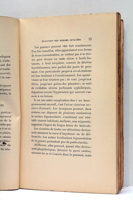 La Syphilis. Syphilis tertiaire et hérédo-syphilis.