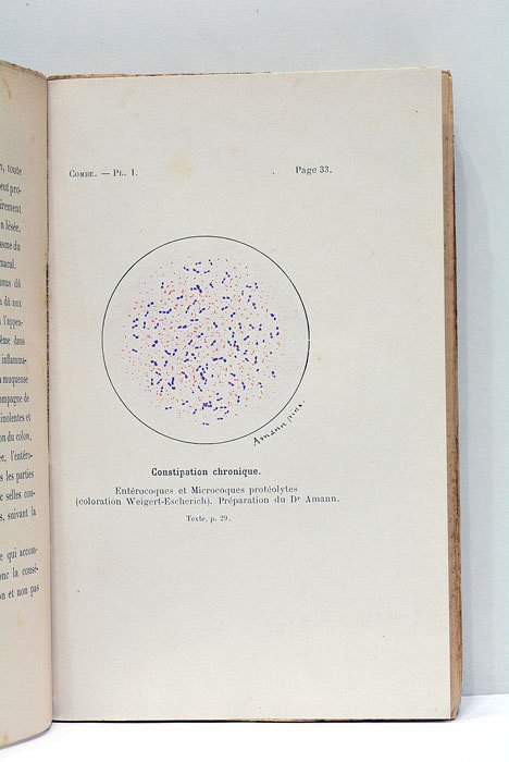 Le traitement de l'entérite muco-membraneuse.