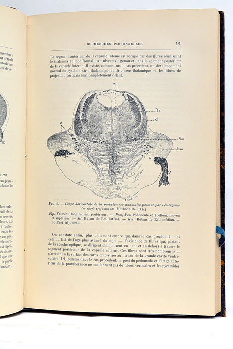 Les Voies Centrales de la Sensibilité Générale (Etude Anatomo-Clinique).
