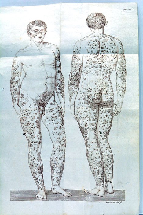 Mémoire et Rapports sur les fumigations sulfureuses appliquées au traitement …