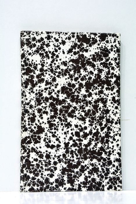 Mémoires sur les Tumeurs du Périoste Dentaire. Lu à la …