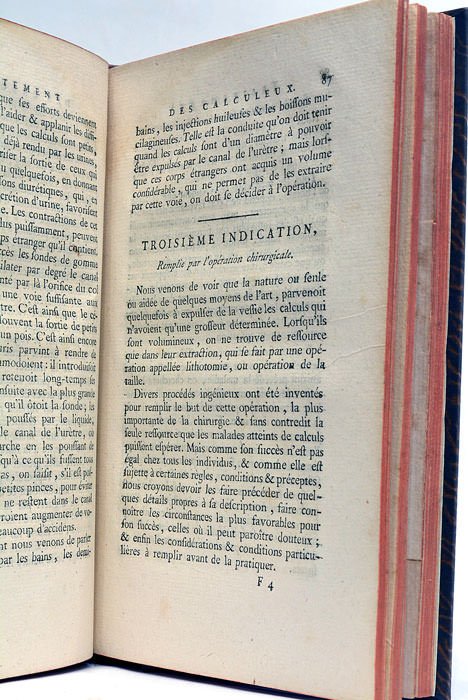 Parallèle des diverses méthodes proposées pour l'extraction des Calculs Vésicaux …
