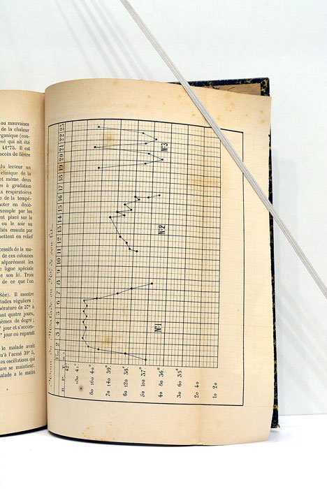 Pathologie clinique du grand sympathique. Étude basée sur l'anatomie et …