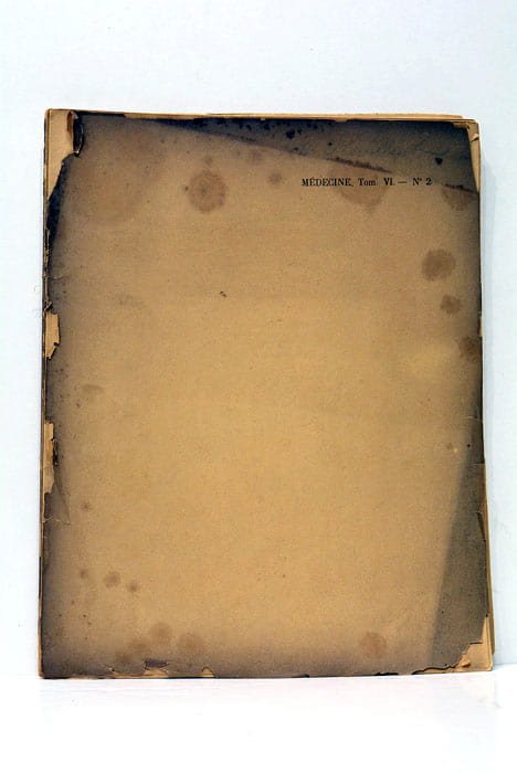 Recherches sur la Toxicité de l'Urine normale et pathologique.