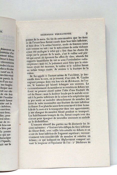 Remarques Nouvelles sur l'Extension Permanente. Appliquée aux fractures très obliques …