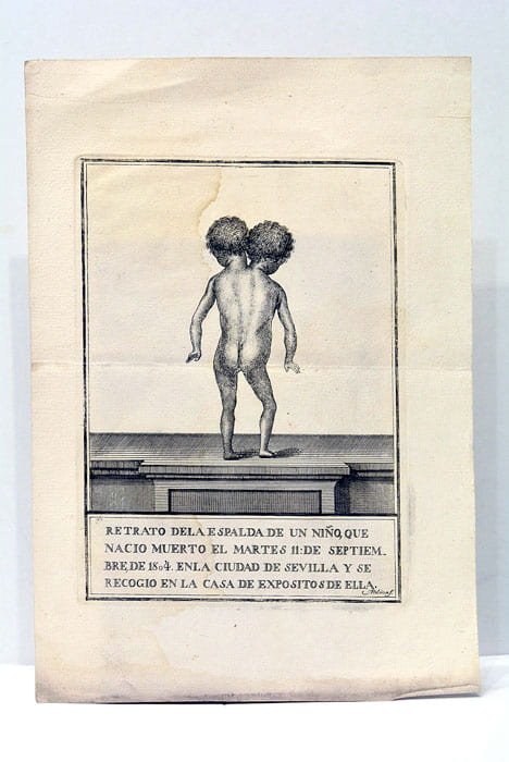 Retrato de la espalda de un niño, que nació muerto …