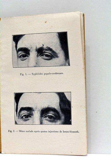 Solubles ou Insolubles.