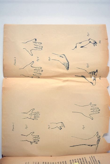 Thèse pour le doctorat en médecine présentée et soutenue le …