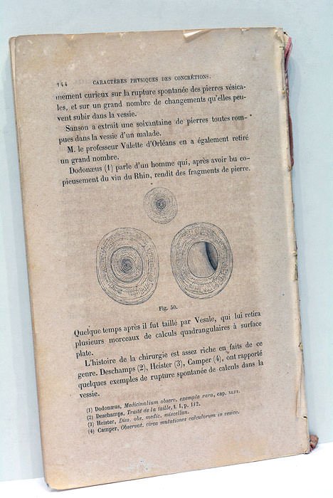 Traité pratique de la Gravelle et des Calculs urinaires. Avec …