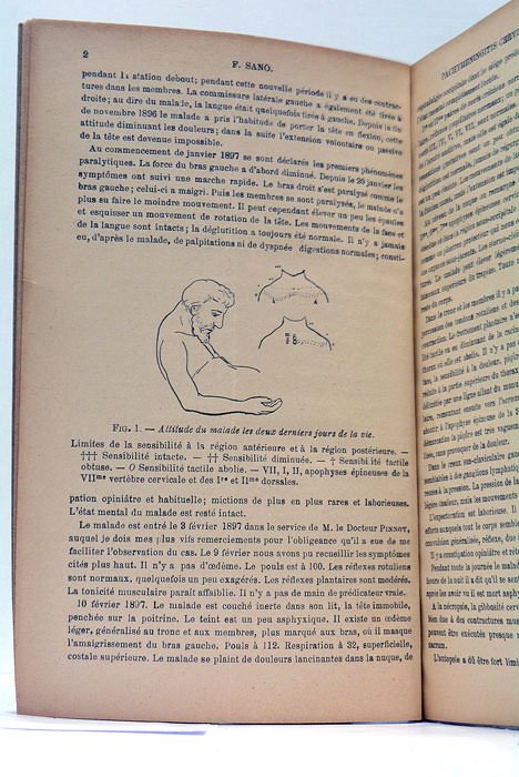 Traitement chirurgical de la paralysie faciale consécutive à un traumatisme …