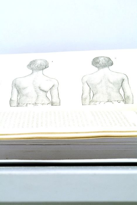 Traitement des Déviations de la Taille sans Appareils. Faits Pratiques.